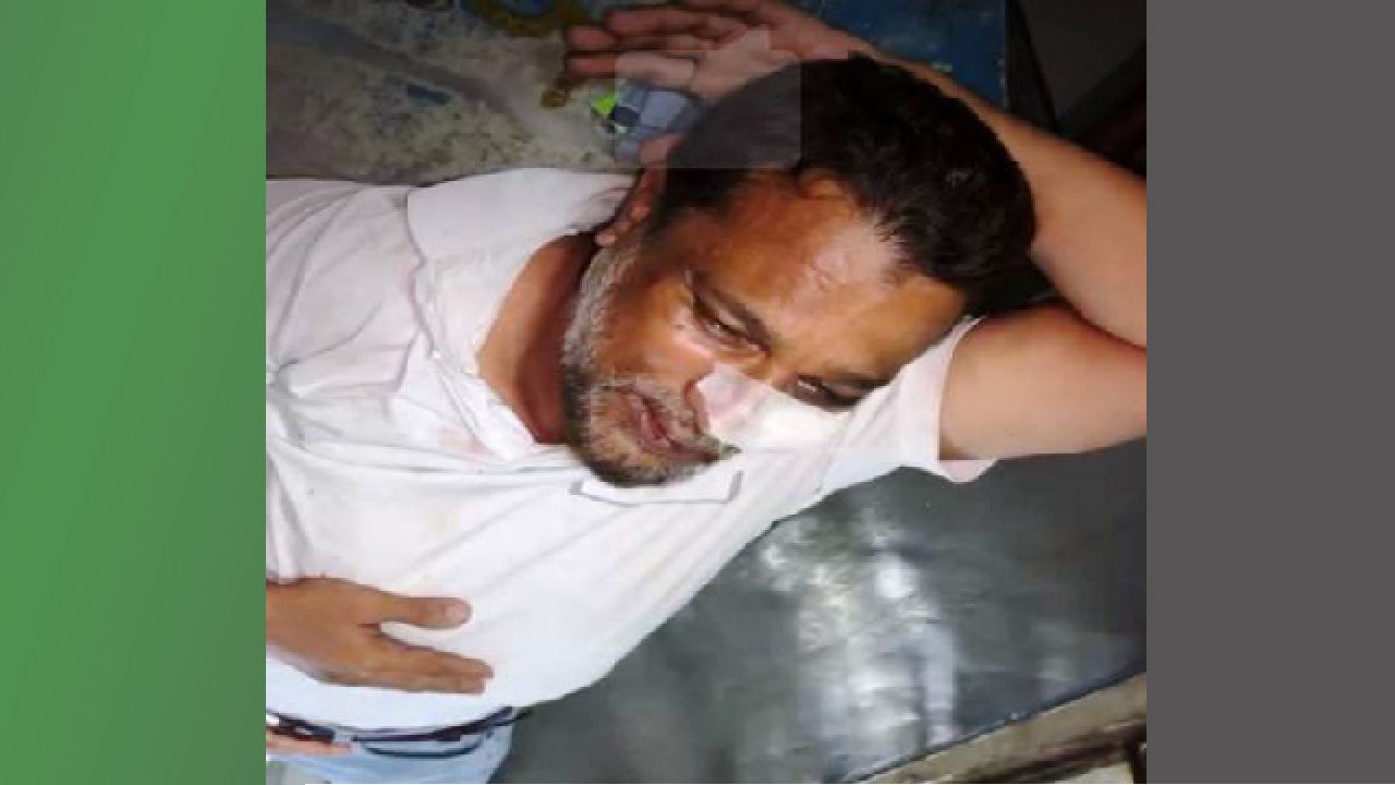 ​খুলনায় জমি সংক্রান্ত বিরোধে দুই গ্রুপের সংঘর্ষ, পেশাগত দায়িত্ব পালনকালে সাংবাদিক আহত