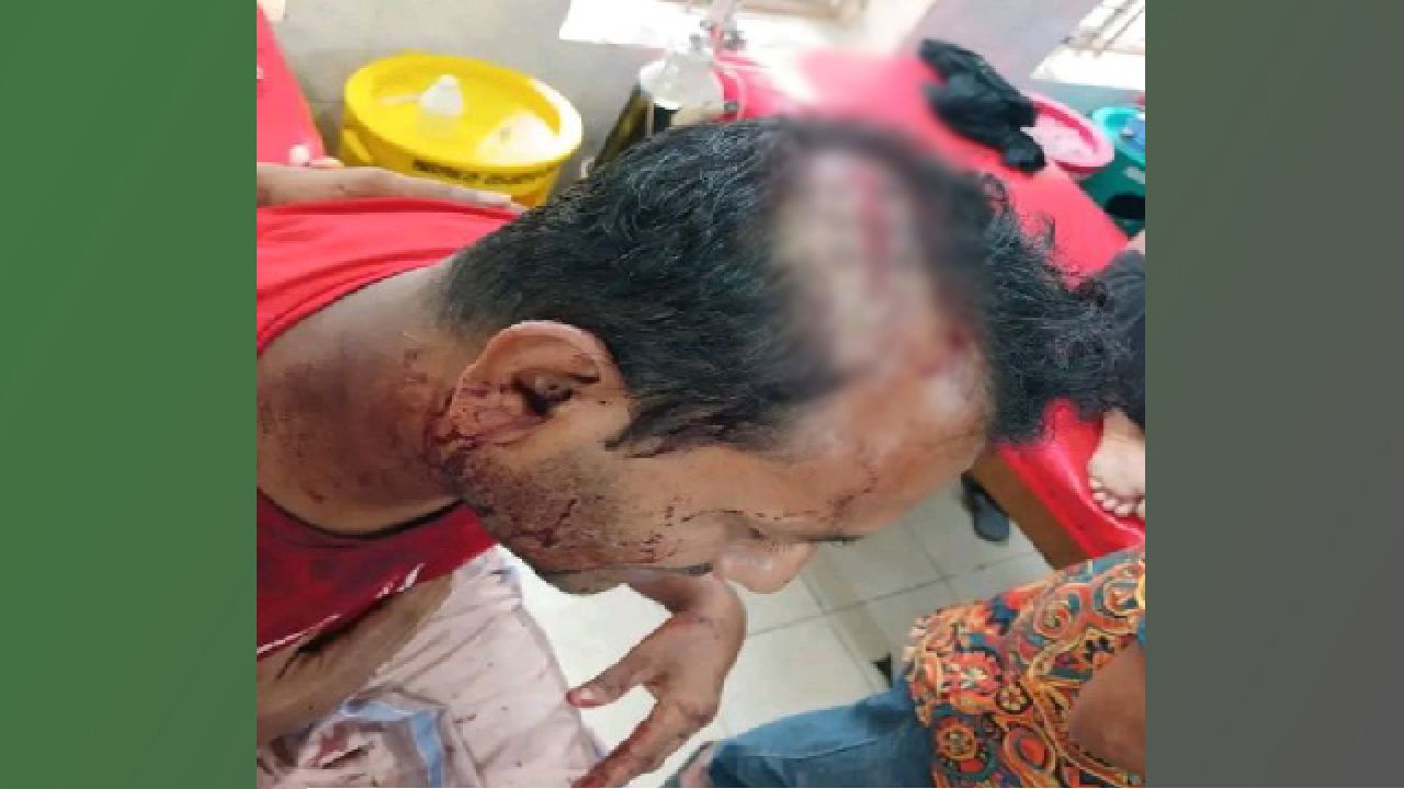 ঝালকাঠিতে ক্লিনিকের সামনে এক যুবকের ওপর দেশীয় অস্ত্র দিয়ে হামলা আহত ১