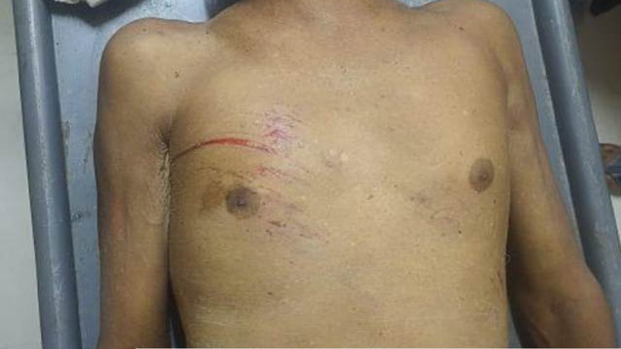 তানোরে মোটরসাইকেলদূর্ঘটনায় বৃদ্ধার মৃত্যু